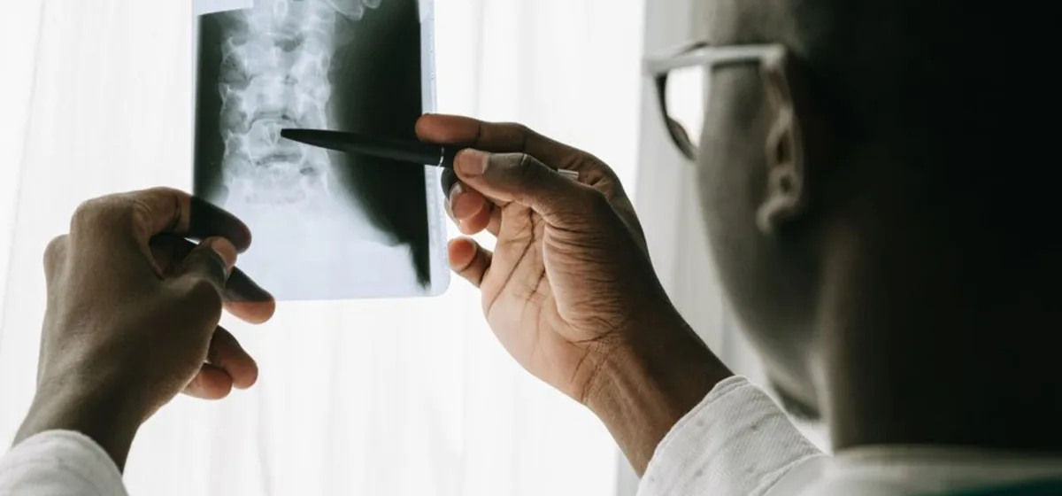 Tucson AZ Chiropractors May Help Scoliosis